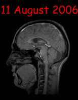 my brain 11 August 2006