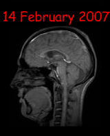 my brain 14 February 2007