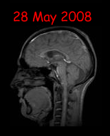 my brain 28 may 2008
