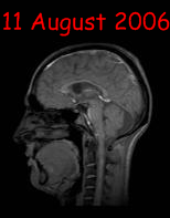 my brain 11 August 2024