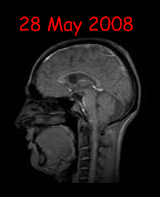 my brain 28 may 2024